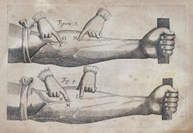 William Harvey - Discovery of The Circulation of Blood